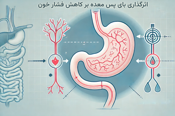 اثرگذاری بای‌ پس معده بر کاهش فشار خون