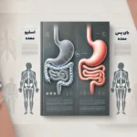 تفاوت بین اسلیو و بای پس معده