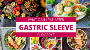 بعد از عمل اسلیو معده چی بخوریم؟ برنامه غذایی پیشنهادی