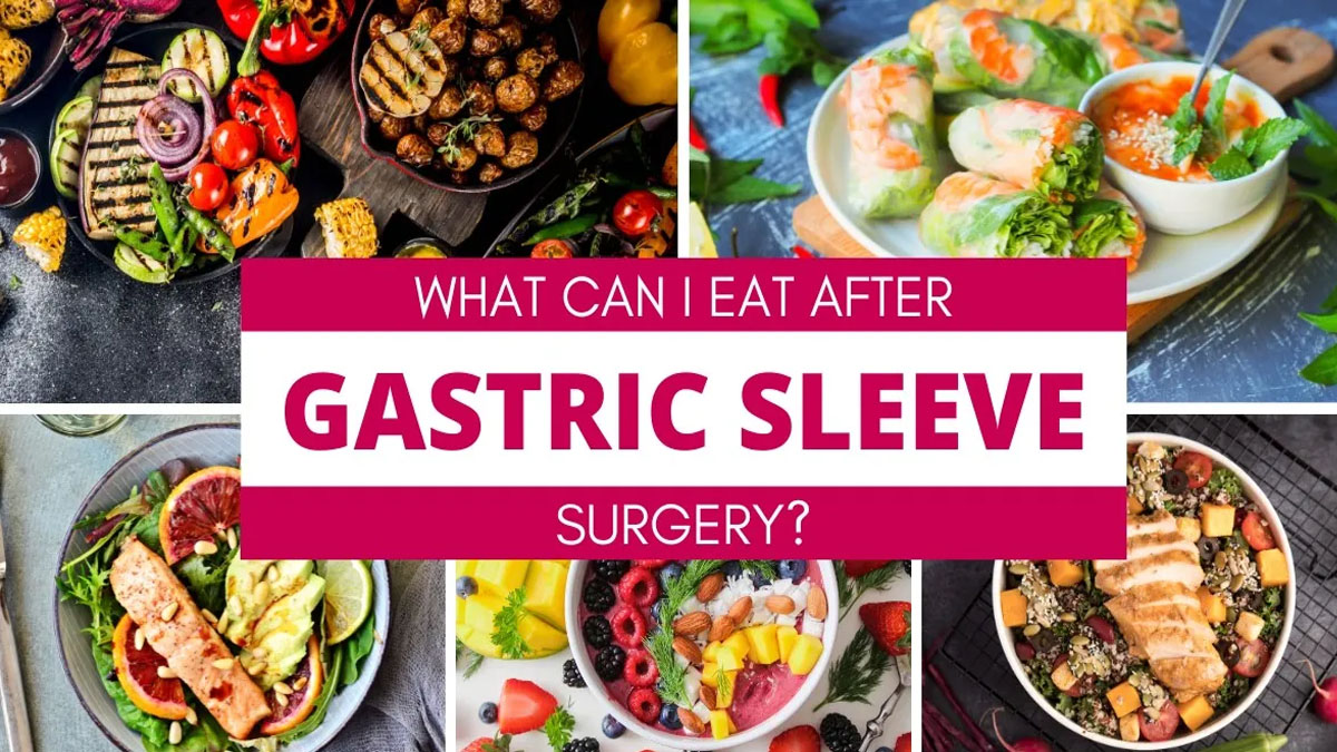 بعد از عمل اسلیو معده چی بخوریم؟ برنامه غذایی پیشنهادی