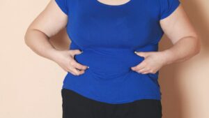 چگونه BMI بر نتیجه اسلیو معده تأثیر می‌ گذارد؟