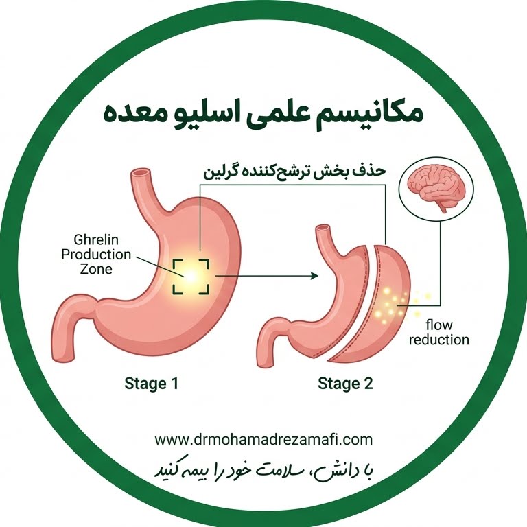 کش امدن معده