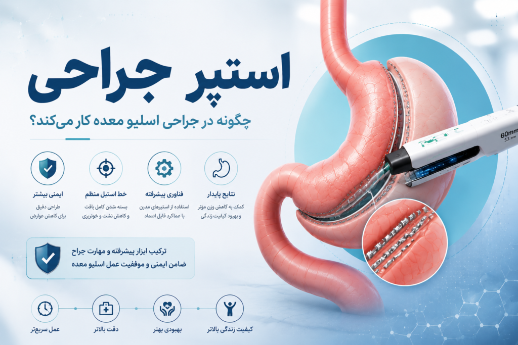استپر جراحی اسلیو معده