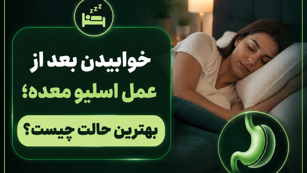 خوابیدن بعد از اسلیو معده