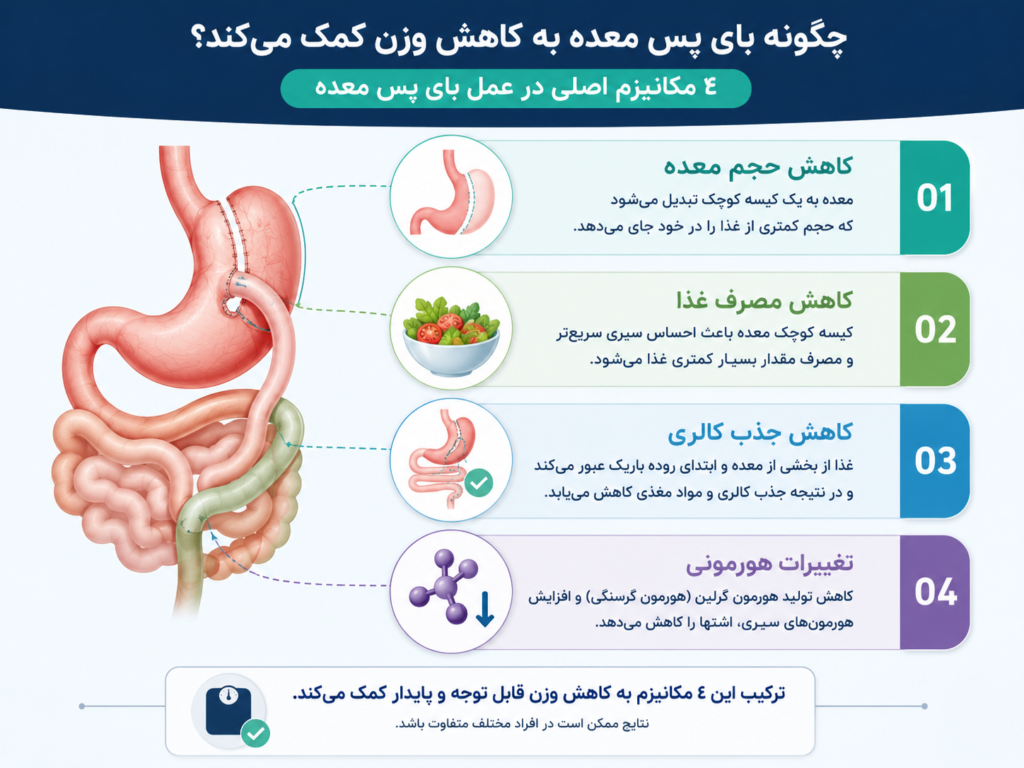 مزایای بای پس معده؛ چرا این جراحی برای برخی بیماران بهترین انتخاب است؟