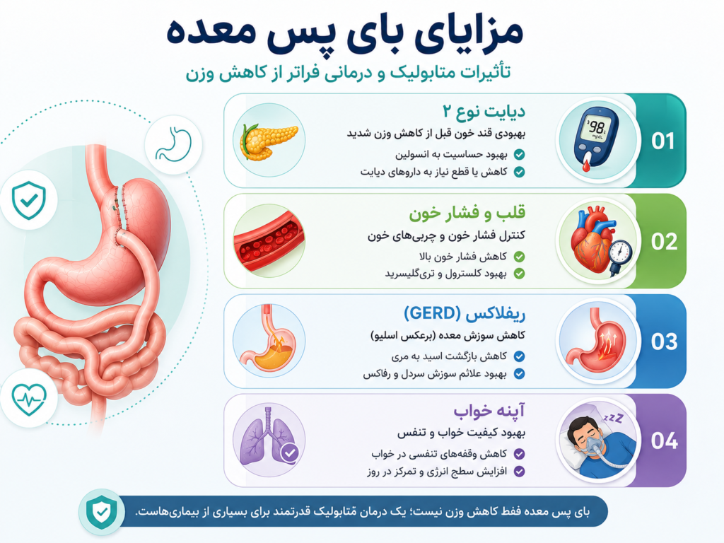 مزایای بای پس معده 