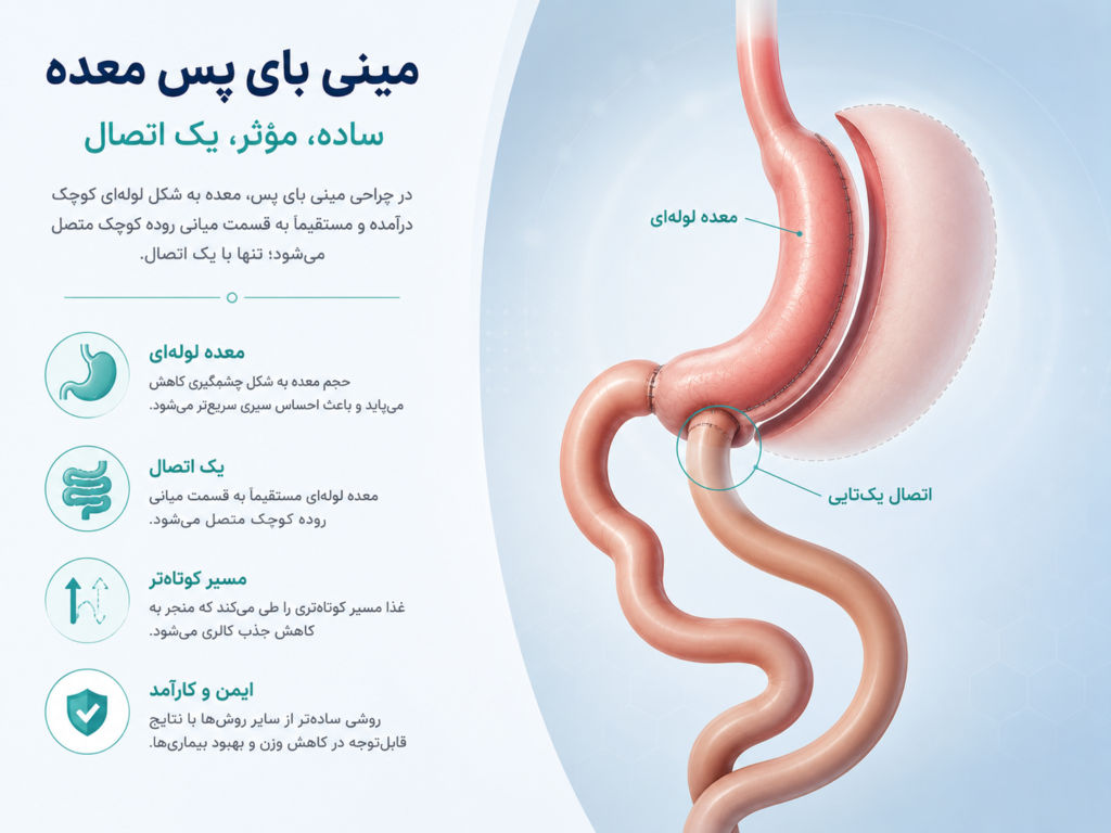 جراحی مینی بای پس چگونه انجام می‌شود؟