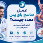 عمل ساسج بای پس معده چیست؟