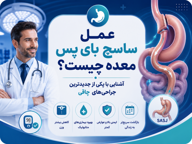عمل ساسج بای پس معده؛ 5 نکته مهم که باید بدانید