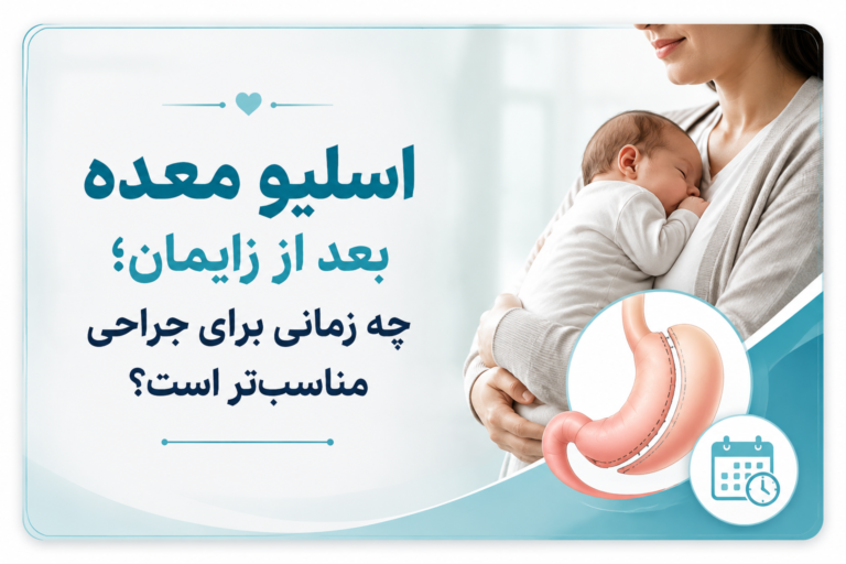 5نکته حیاتی برای اسلیو معده بعد از زایمان و شیردهی