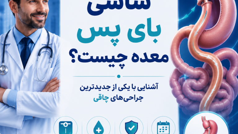 ساسی بای پس معده؛ کم خطرترین روش لاغری