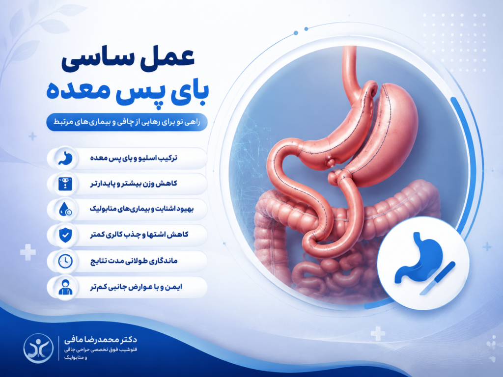 ساسی بای پس معده؛ کم خطرترین روش لاغری
