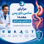 مزایای ساسی بای پس معده؛ کم خطرترین روش لاغری