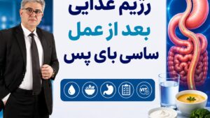رژیم غذایی بعد از عمل ساسی بای پس