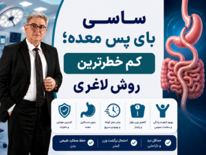 ساسی بای پس معده؛ کم خطرترین روش لاغری