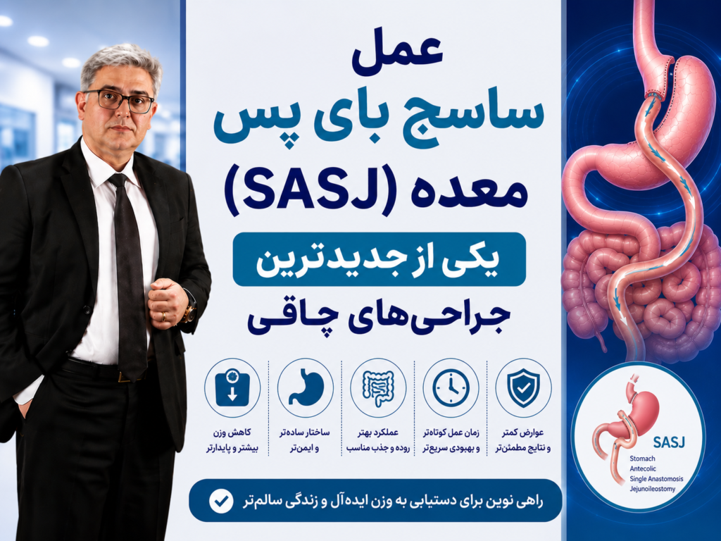 ساسی بای پس معده؛ کم خطرترین روش لاغری