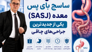 ساسی بای پس معده؛ کم خطرترین روش لاغری