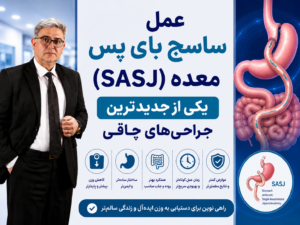 ساسی بای پس معده؛ کم خطرترین روش لاغری